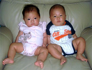 Acupuncture for IVF Support to get Twins