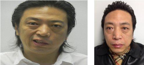 Acupuncture for Bell’s palsy