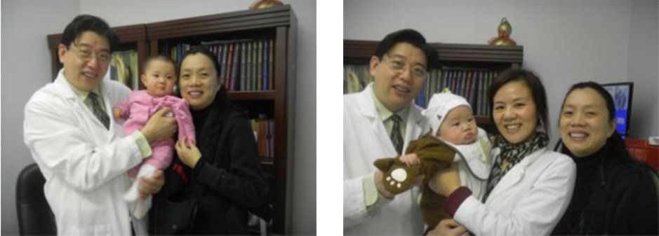 Acupuncture for IVF Support Twins