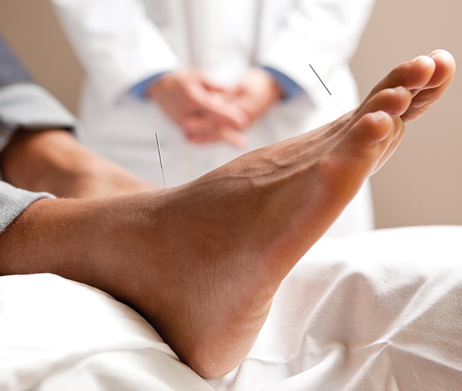 针灸