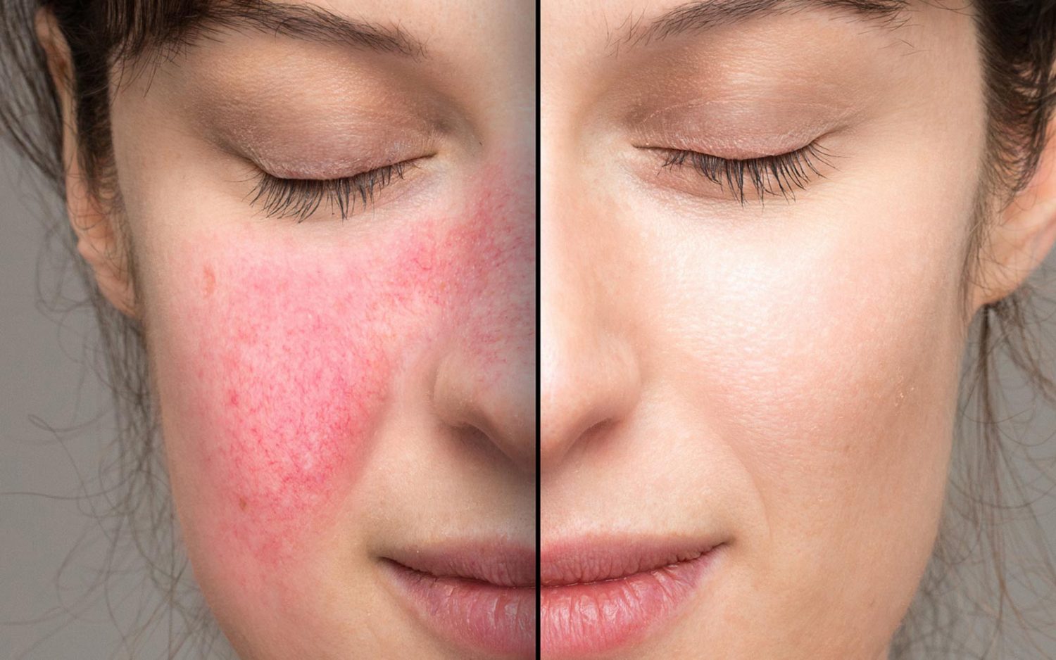 皮肤科医生,皮肤科 法拉盛,医美,医美诊所,医美美容院,医病美容,飞越皇后皮肤科,皮肤科医生推荐,魏华臣皮肤科,皮肤过敏,纽约最好的皮肤科医生,布鲁克林皮肤科,皮肤科医生 法拉盛,皮肤病专家,纽约精英皮肤科,皮肤科 布鲁克林,布鲁克林皮肤科医生,皮肤诊所,激光祛斑,皮肤专科,皮肤医生,皮肤科医生 唐人街,皮肤专科医生,皮肤专家,皮肤专科诊所,皮肤科专家,皮肤病诊所,皮肤病医生,美容皮肤科,皮肤美容科,皮肤病专科,皮肤病专科医生,皮肤病科,皮肤病医院,皮肤医院,最好的皮肤科医生,切痣手术,去痣手术,看皮肤科医生,皮肤科排名,皮肤科湿疹,皮肤科诊所,皮肤问题,皮肤美容,皮肤专科医院