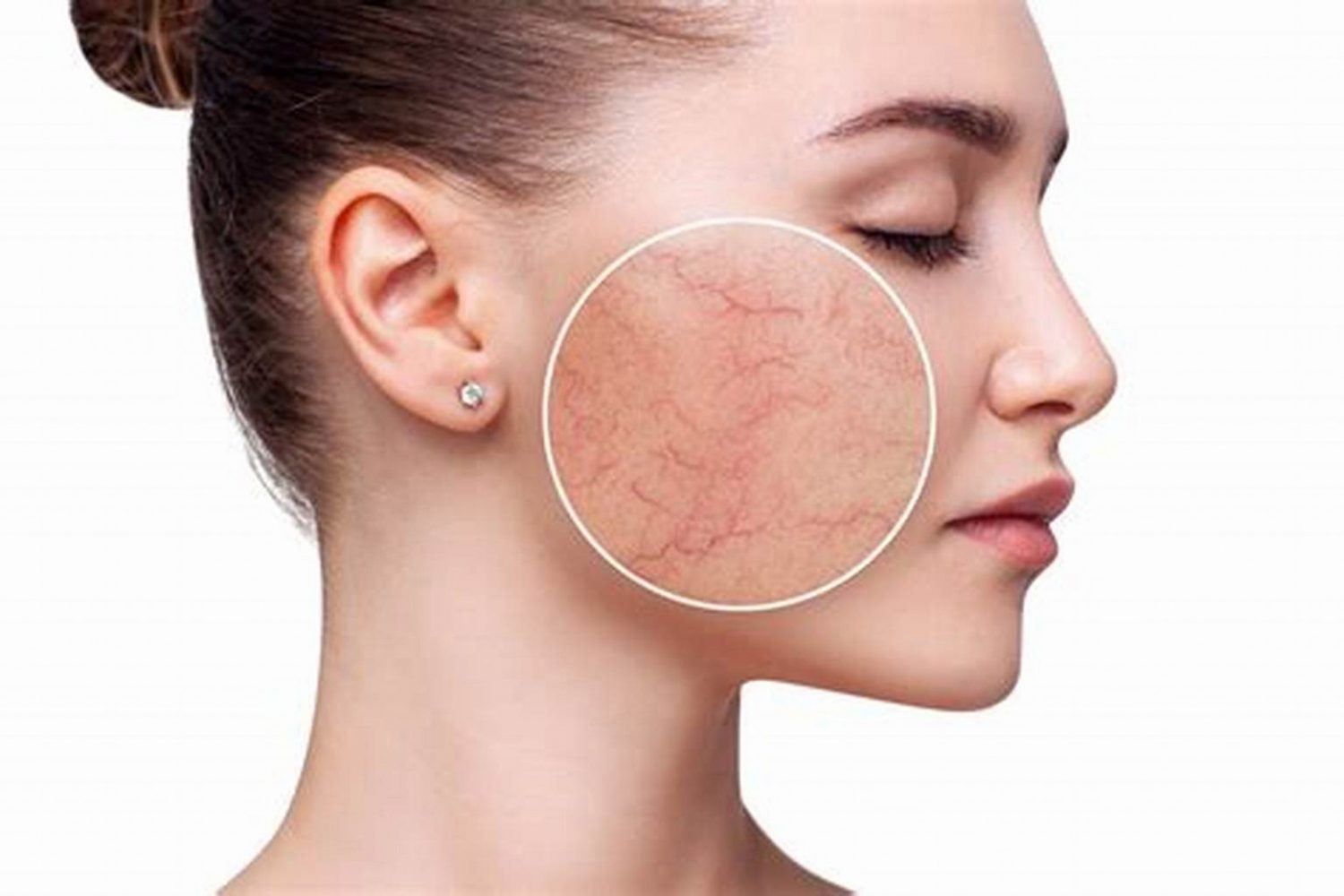 皮肤科医生,皮肤科 法拉盛,医美,医美诊所,医美美容院,医病美容,飞越皇后皮肤科,皮肤科医生推荐,魏华臣皮肤科,皮肤过敏,纽约最好的皮肤科医生,布鲁克林皮肤科,皮肤科医生 法拉盛,皮肤病专家,纽约精英皮肤科,皮肤科 布鲁克林,布鲁克林皮肤科医生,皮肤诊所,激光祛斑,皮肤专科,皮肤医生,皮肤科医生 唐人街,皮肤专科医生,皮肤专家,皮肤专科诊所,皮肤科专家,皮肤病诊所,皮肤病医生,美容皮肤科,皮肤美容科,皮肤病专科,皮肤病专科医生,皮肤病科,皮肤病医院,皮肤医院,最好的皮肤科医生,切痣手术,去痣手术,看皮肤科医生,皮肤科排名,皮肤科湿疹,皮肤科诊所,皮肤问题,皮肤美容,皮肤专科医院