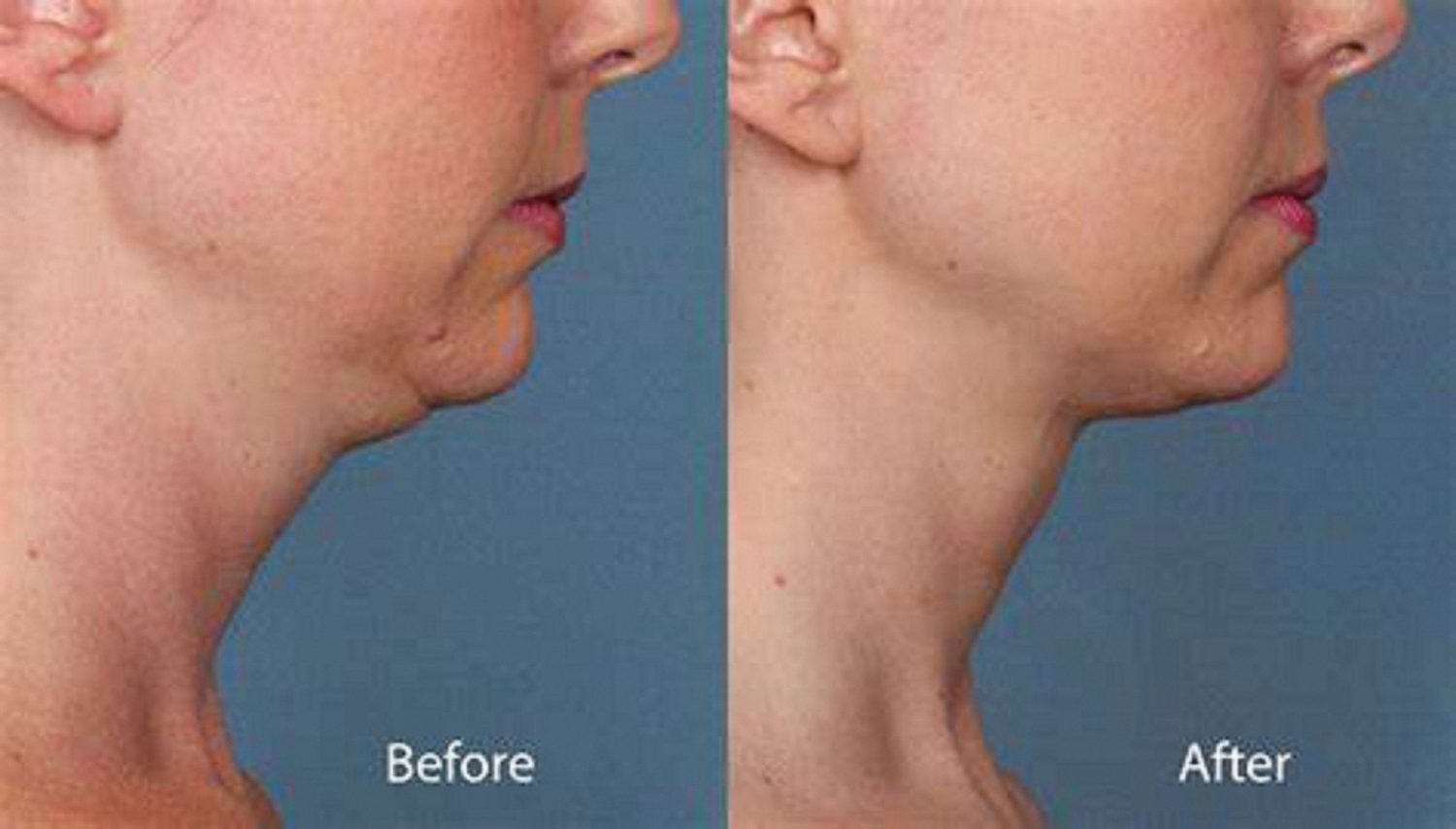 纽约 布鲁克林 法拉盛 曼哈顿 医美 飞越皇后 精英 最好的 美容 皮肤科 皮肤 过敏 美容科 皮肤病 科 专家 专科 医生 诊所 医院 美容院 激光 祛斑 湿疹 排名 推荐