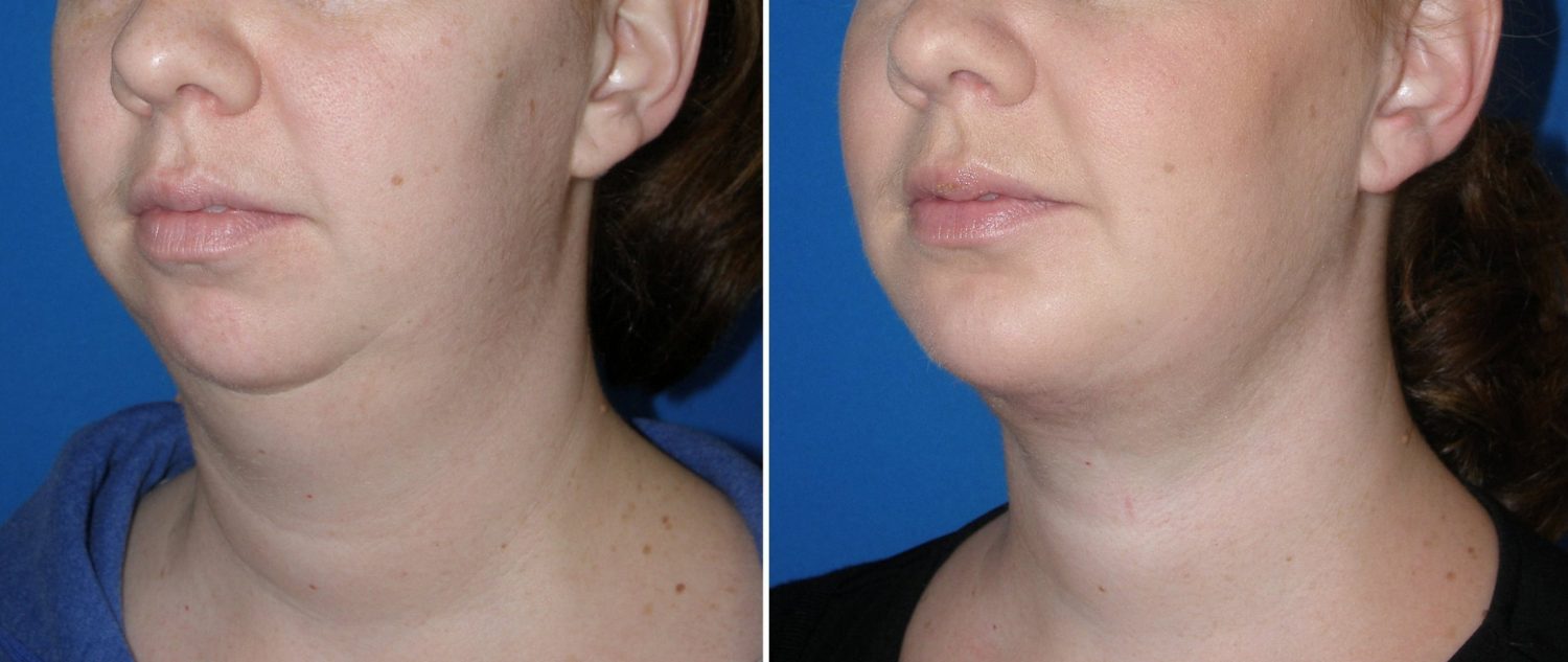 皮肤科医生,皮肤科 法拉盛,医美,医美诊所,医美美容院,医病美容,飞越皇后皮肤科,皮肤科医生推荐,魏华臣皮肤科,皮肤过敏,纽约最好的皮肤科医生,布鲁克林皮肤科,皮肤科医生 法拉盛,皮肤病专家,纽约精英皮肤科,皮肤科 布鲁克林,布鲁克林皮肤科医生,皮肤诊所,激光祛斑,皮肤专科,皮肤医生,皮肤科医生 唐人街,皮肤专科医生,皮肤专家,皮肤专科诊所,皮肤科专家,皮肤病诊所,皮肤病医生,美容皮肤科,皮肤美容科,皮肤病专科,皮肤病专科医生,皮肤病科,皮肤病医院,皮肤医院,最好的皮肤科医生,切痣手术,去痣手术,看皮肤科医生,皮肤科排名,皮肤科湿疹,皮肤科诊所,皮肤问题,皮肤美容,皮肤专科医院