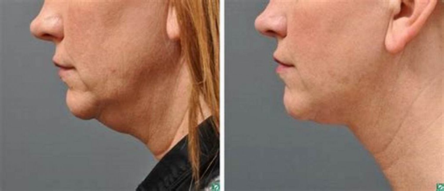 纽约 布鲁克林 法拉盛 曼哈顿 医美 飞越皇后 精英 最好的 美容 皮肤科 皮肤 过敏 美容科 皮肤病 科 专家 专科 医生 诊所 医院 美容院 激光 祛斑 湿疹 排名 推荐