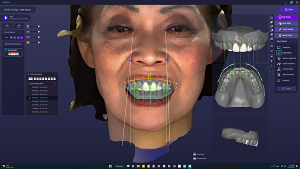 数字化AI设计和制作更容易满足患者的需求。（Plaza Dental Implant Center提供）