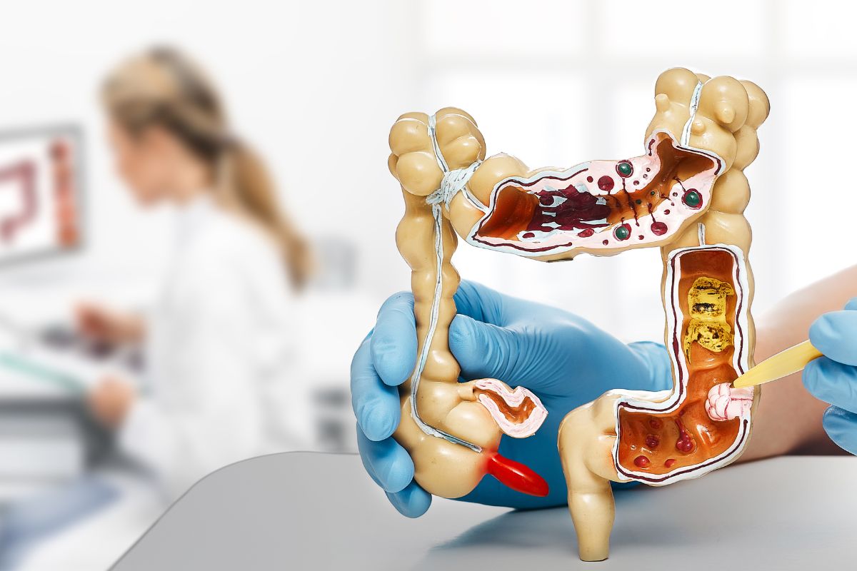 腹痛腹泻 肠胃 便秘 便血