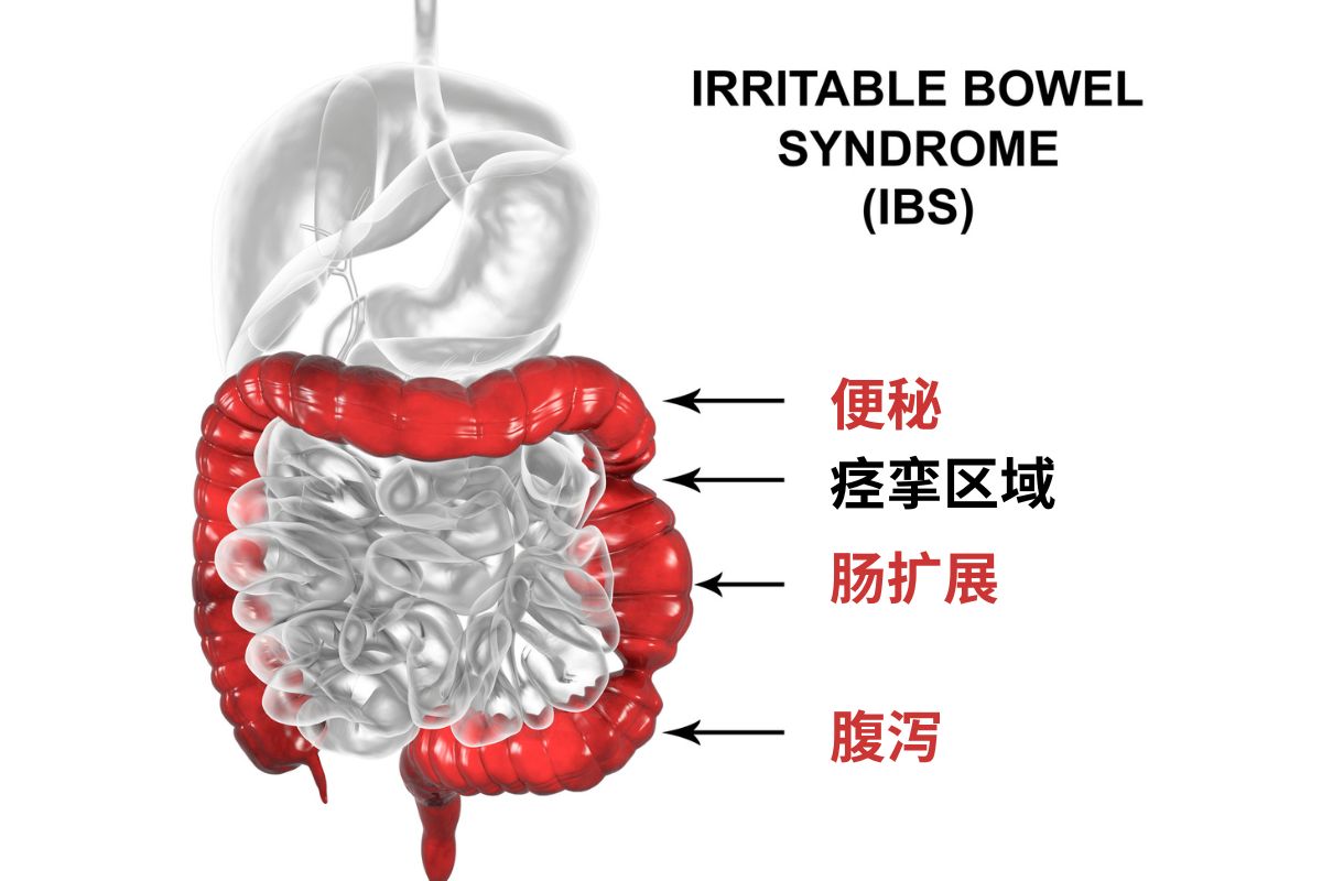 腹痛 腹泻 胀气