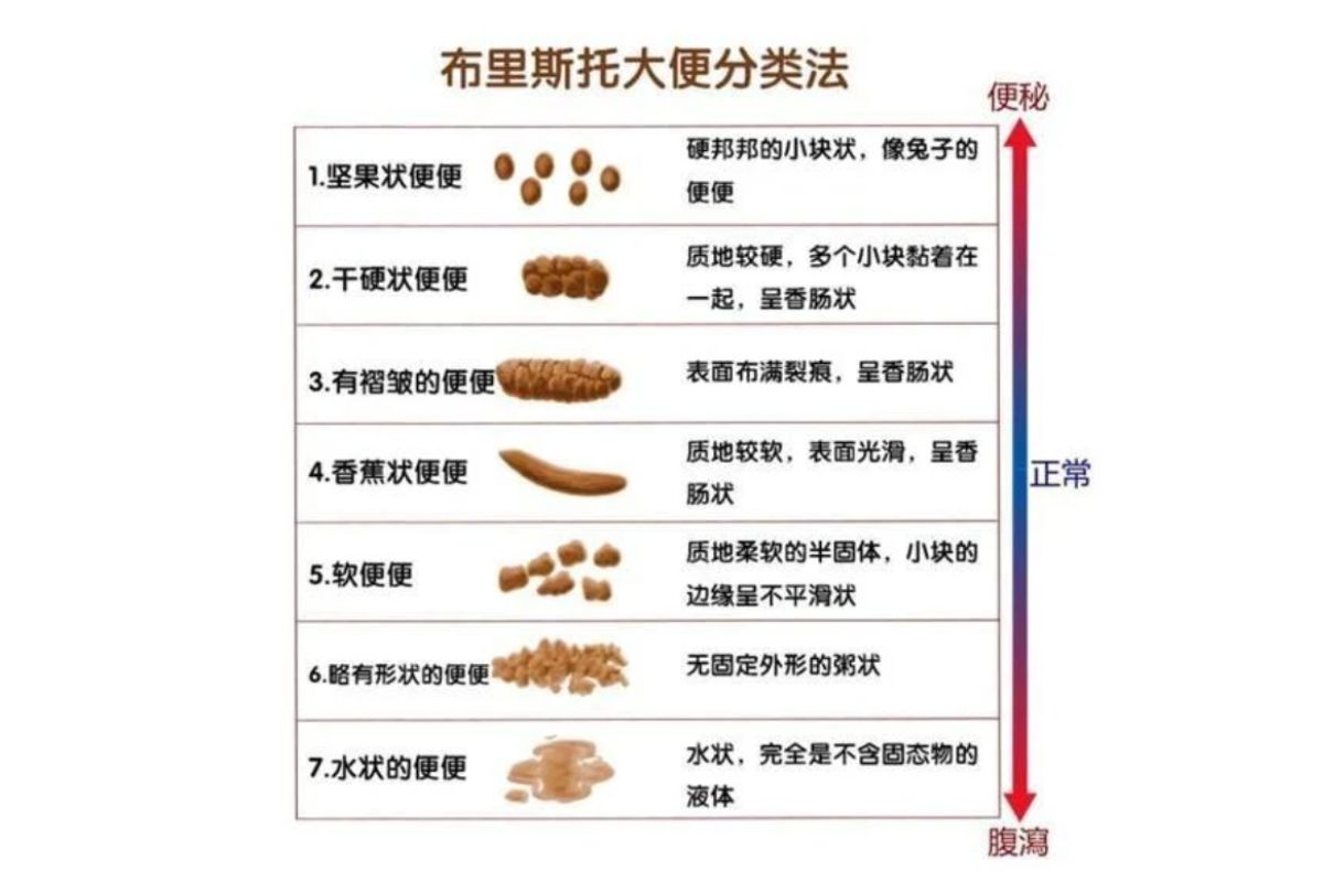 腹痛 便秘 下痢