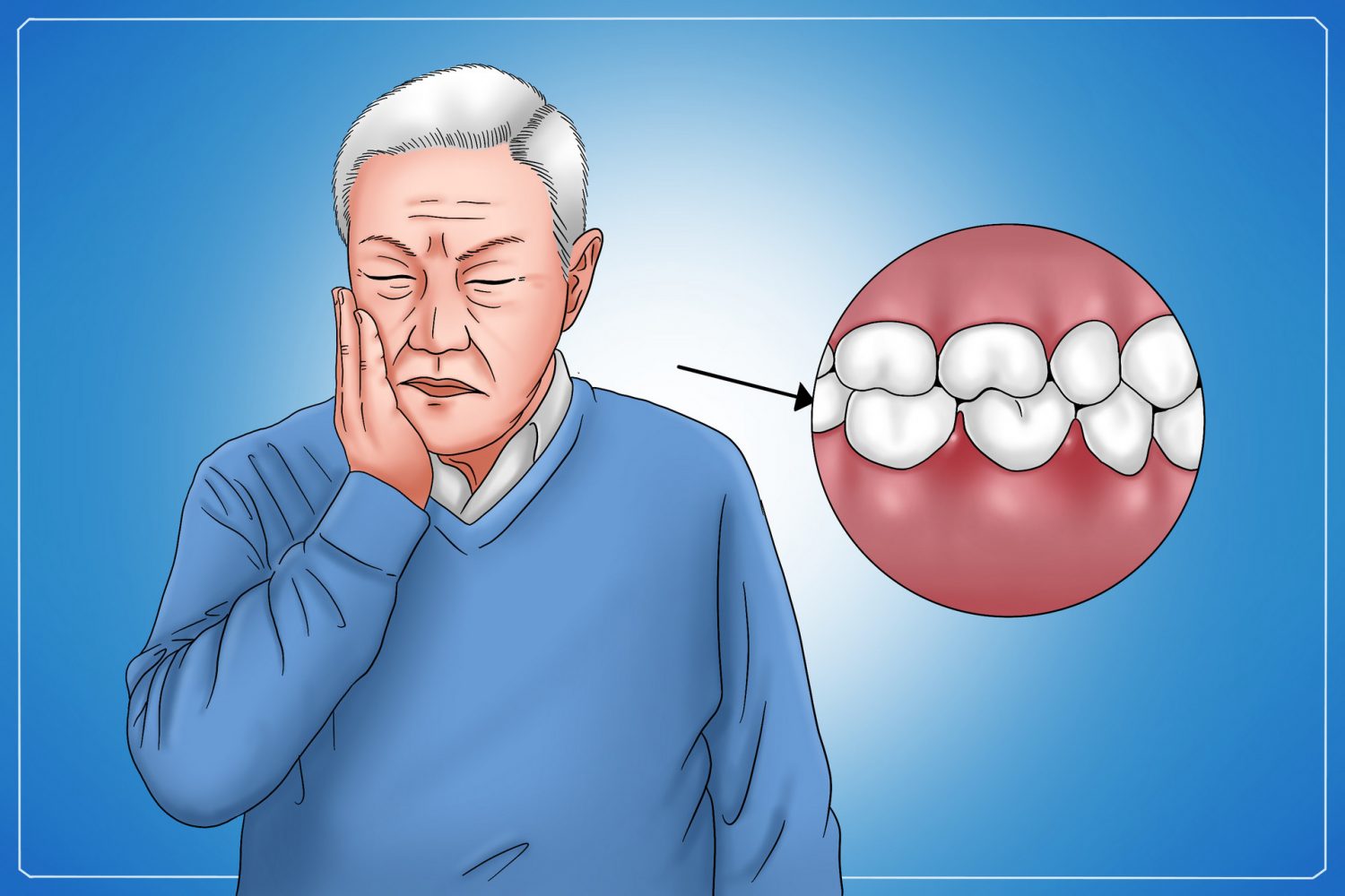 牙周病症状,牙周病,牙龈出血,牙龈红肿,牙齿松动,牙齿敏感