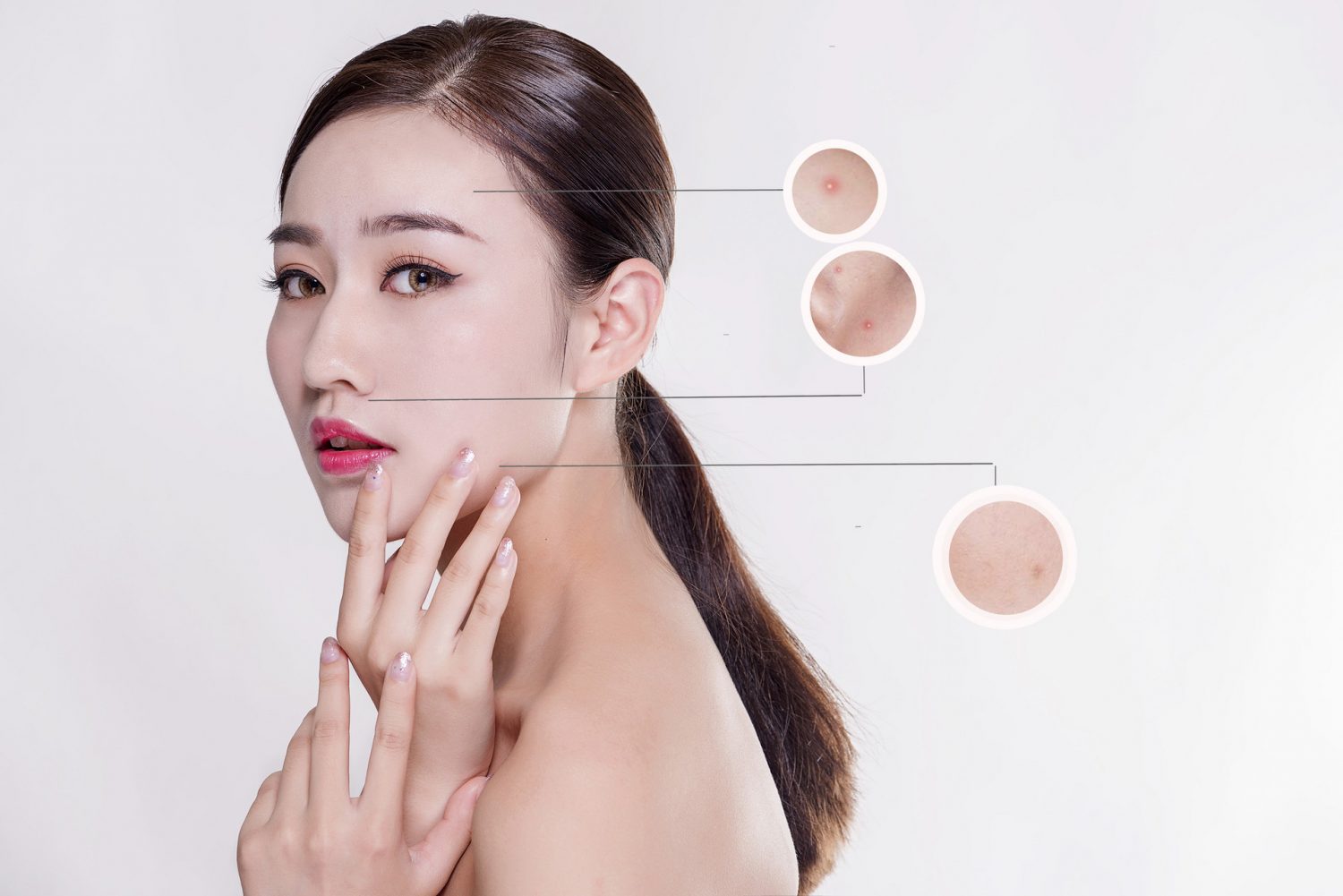 不同类型痤疮的治疗方法