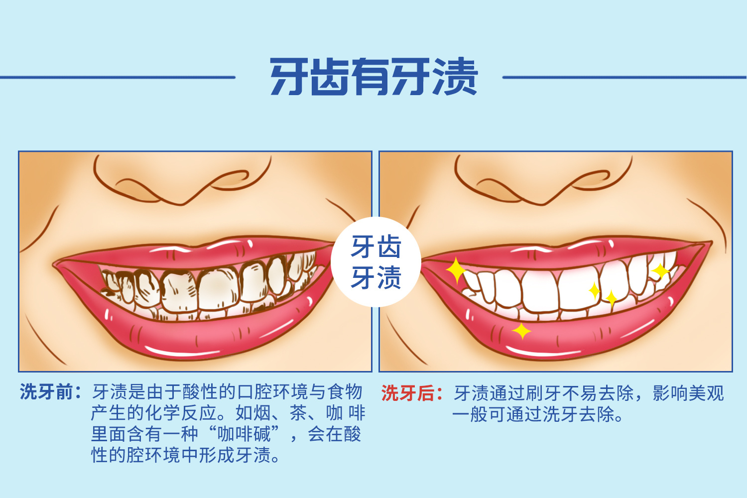 定期洗牙,牙周病,牙结石,牙龈炎,牙齿龋坏,牙周组织,口腔卫生,牙医,牙周检查,牙槽骨,口腔检查,牙菌斑