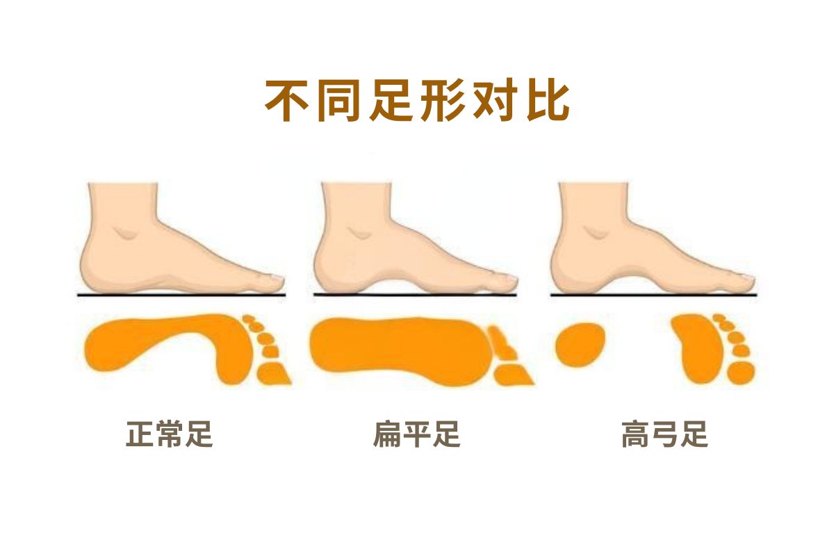 足底疼痛 脚底痛 足底筋膜炎