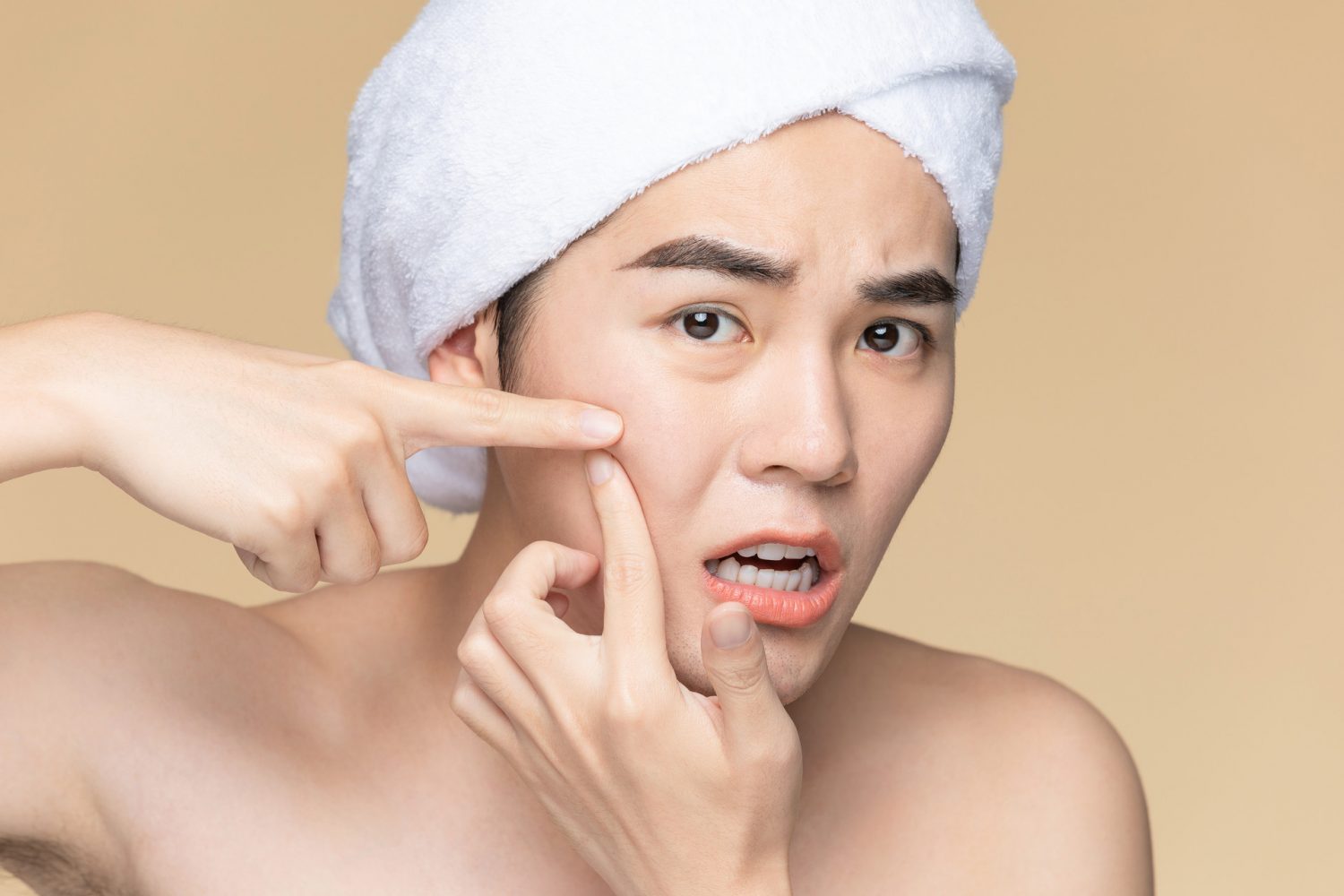 手上的细菌容易引发痘痘感染，切勿抠、挤痘痘。