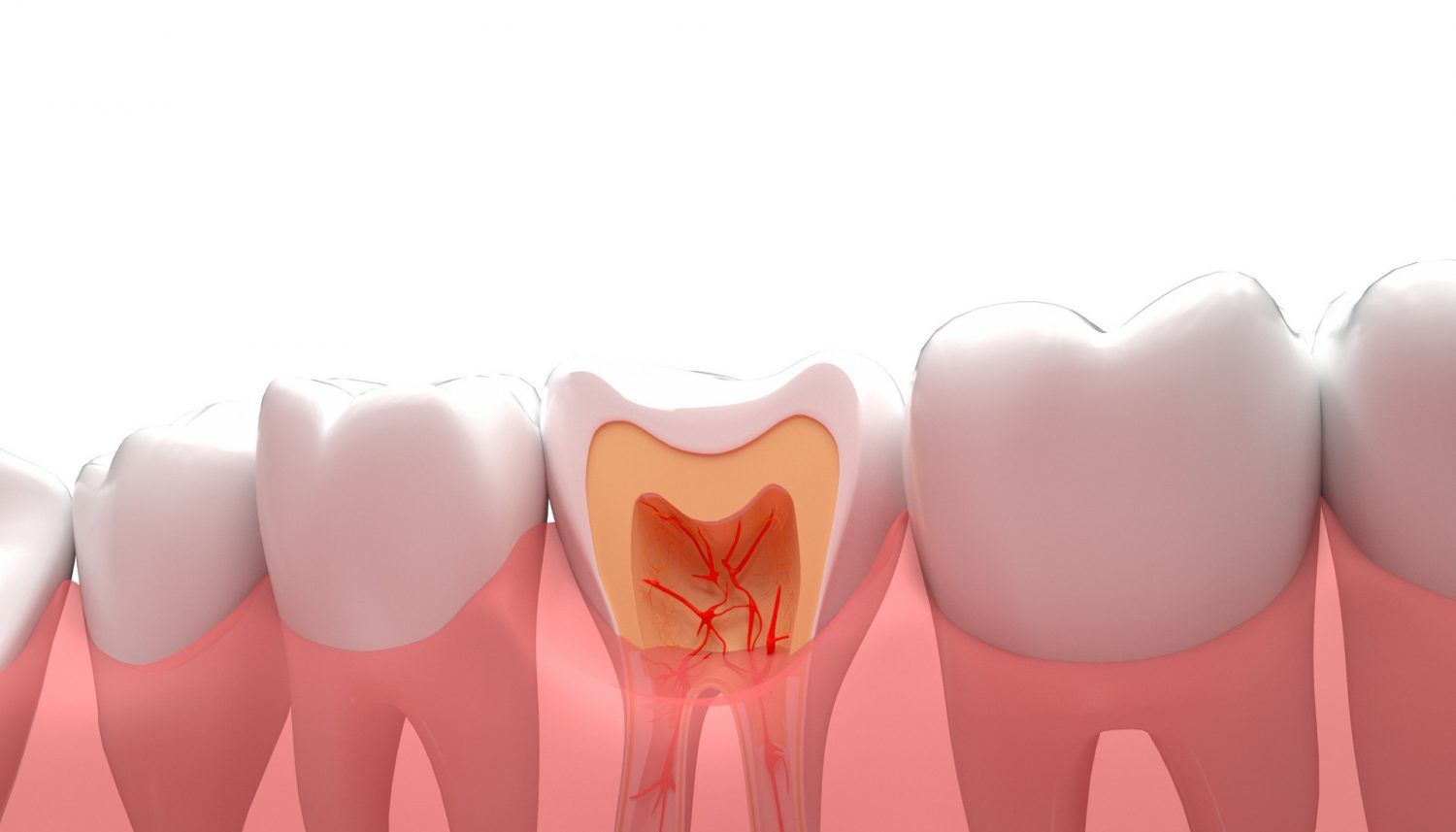 牙齿意外脱落或断裂：应对方法及紧急救治