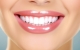 终极指南：牙齿美白技巧与解决牙齿变色问题