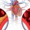 纽约法拉盛心脏病专科医生 （888）950-2655 | 心肌炎 心包炎 先天性心脏病 心律失常 心绞痛